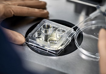 Το σύγχρονο πρόσωπο της εξωσωματικής