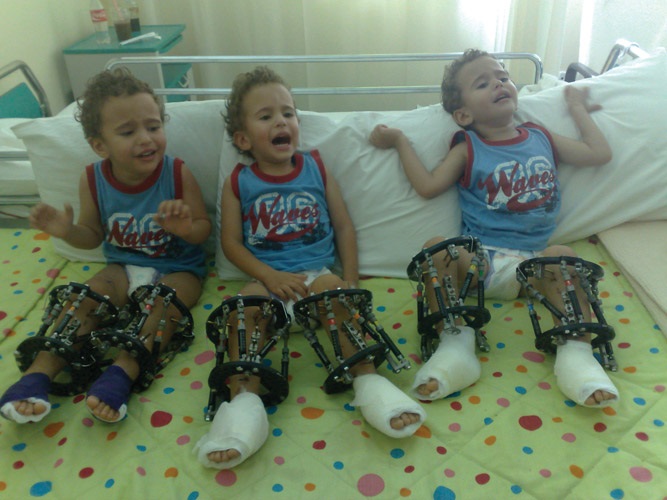 Ανισοσκελία