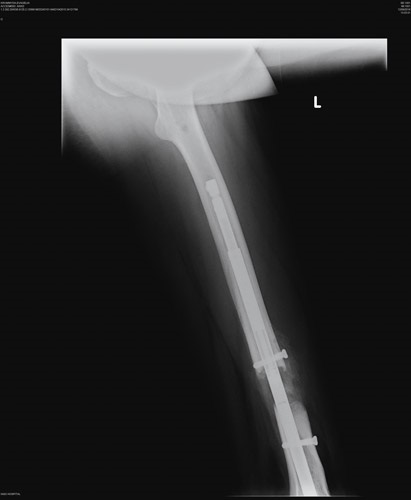 Ανισοσκελία