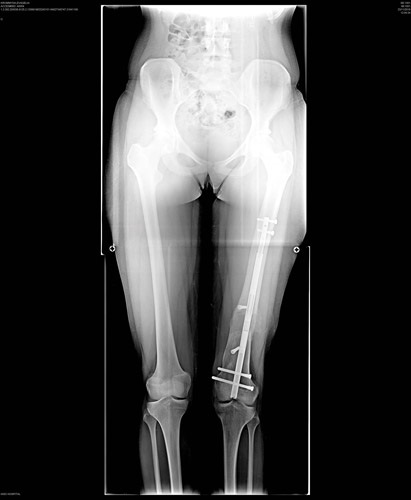 Ανισοσκελία