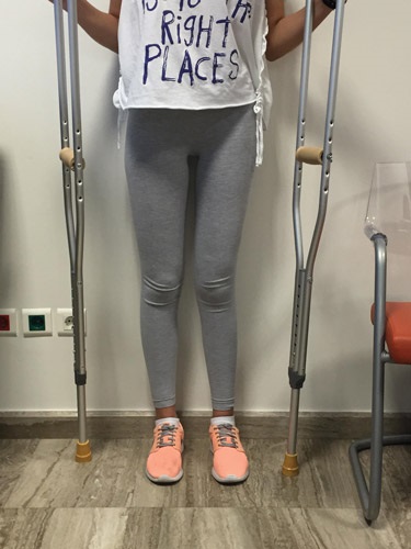 Ανισοσκελία