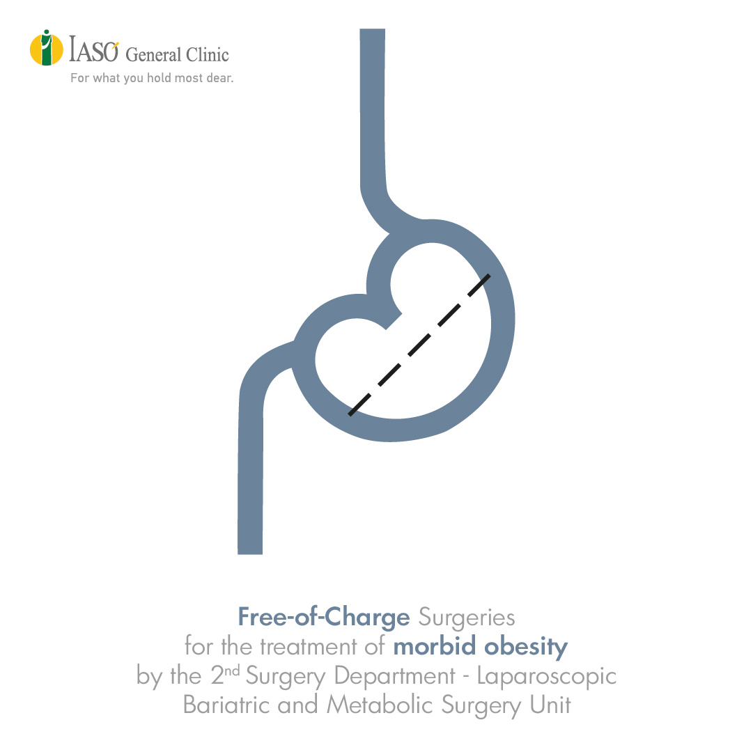 IASO General Clinic: Free-of-Charge Surgeries for the treatment of Morbid Obesity by the 2nd Surgery Department - Laparoscopic Bariatric and Metabolic Surgery Unit