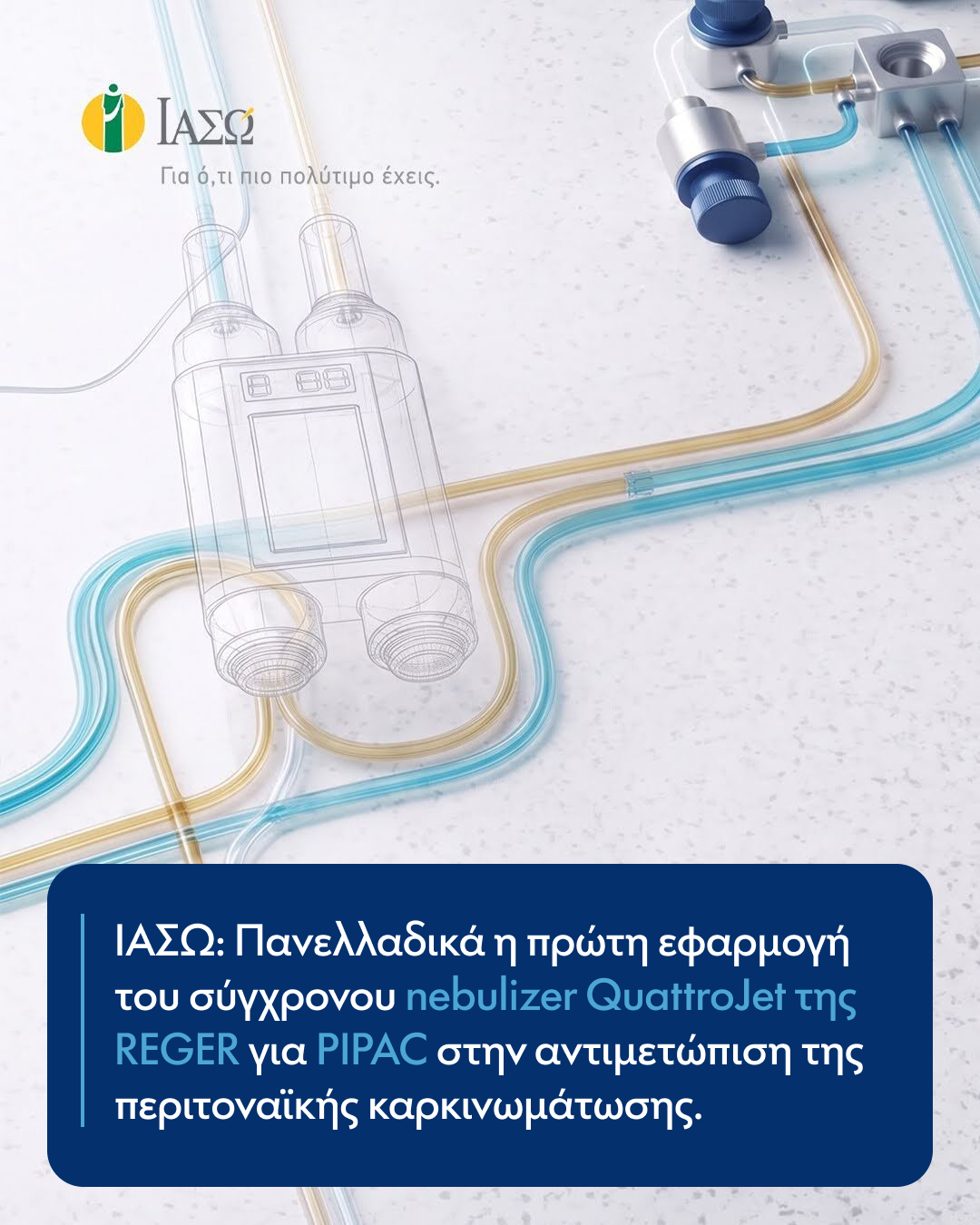 ΙΑΣΩ: Πανελλαδικά η πρώτη εφαρμογή του σύγχρονου nebulizer QuattroJet της REGER για PIPAC στην αντιμετώπιση της περιτοναϊκής καρκινωμάτωσης