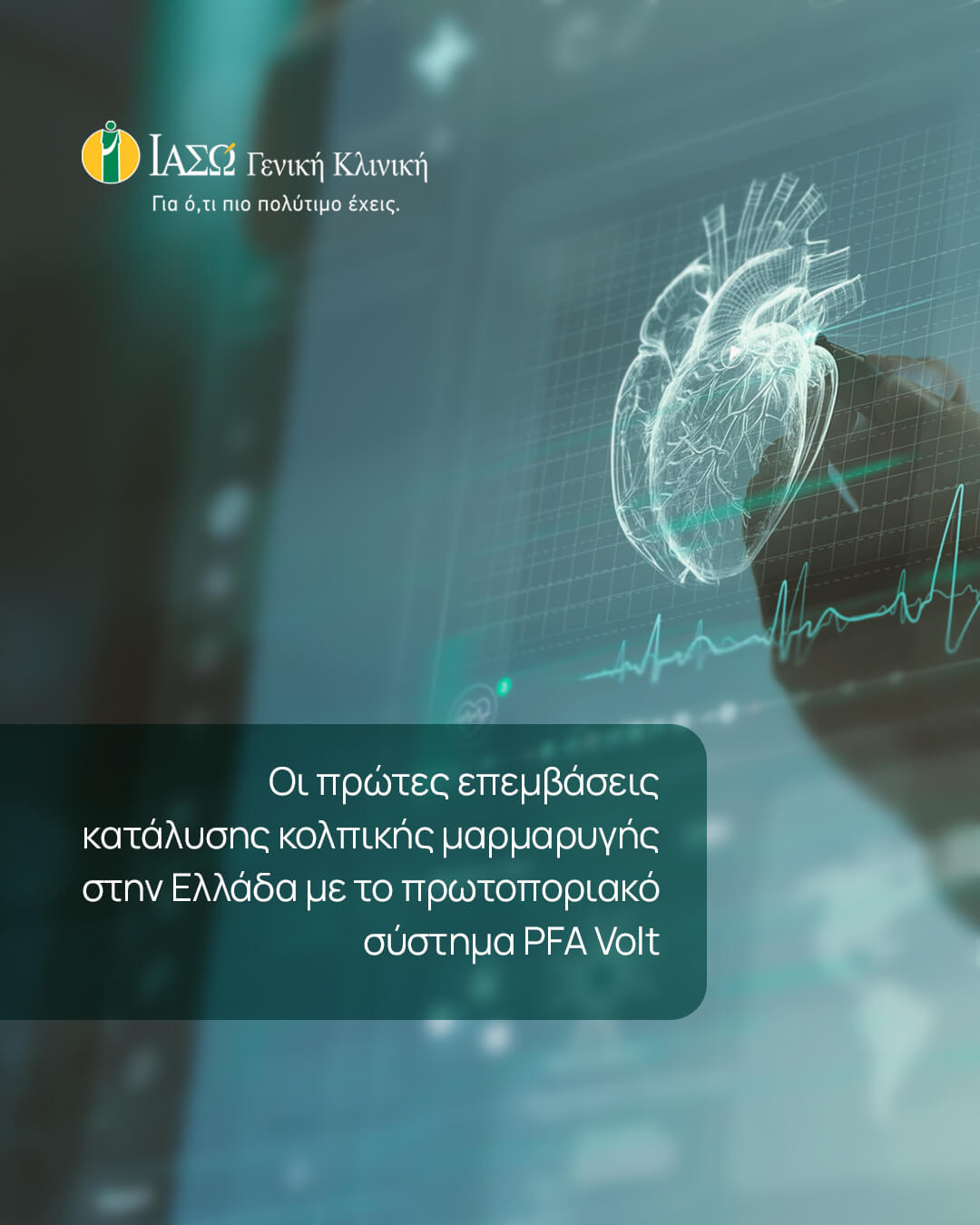ΙΑΣΩ Γενική Κλινική: Οι πρώτες επεμβάσεις κατάλυσης κολπικής μαρμαρυγής στην Ελλάδα με το πρωτοποριακό σύστημα PFA Volt