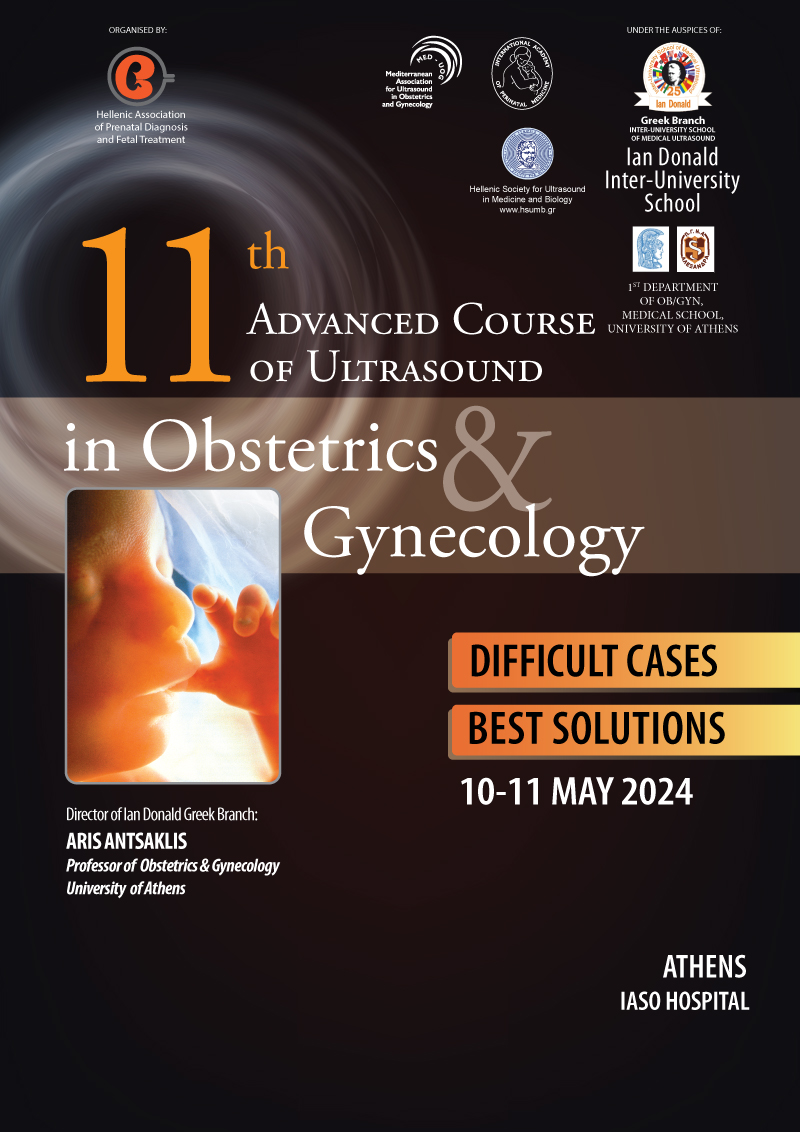 IASO: "Ian Donald – 11th Advanced Course of Ultrasound in Obstetrics & Gynecology: Difficult Cases – Best Solutions" Seminar IASO: "Ian Donald – 11th Advanced Course of Ultrasound in Obstetrics & Gynecology: Difficult Cases – Best Solutions" Seminar