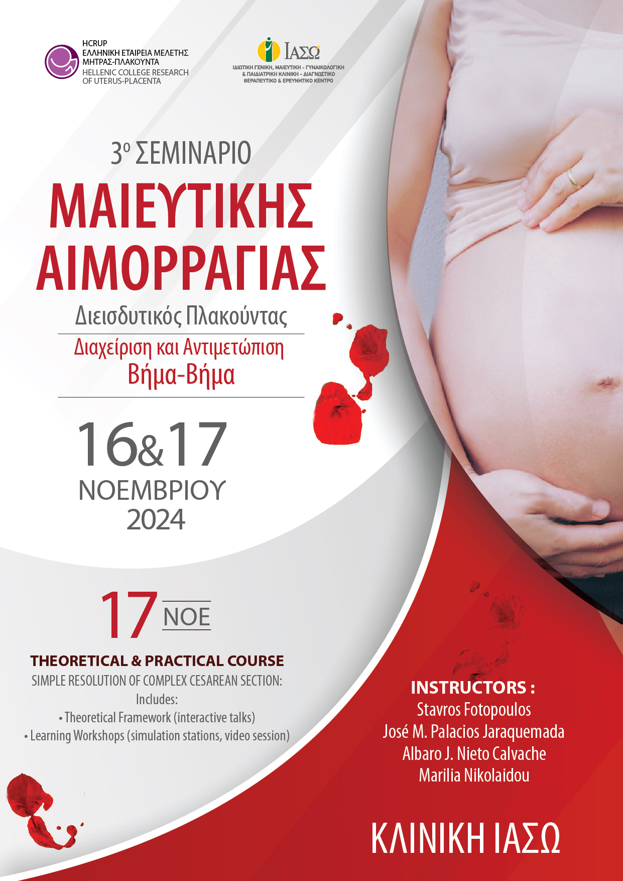 ΙΑΣΩ: Workshop “Complex C Section” – 3ο Σεμινάριο θέμα: «Μαιευτική Αιμορραγία Διεισδυτικός Πλακούντας: Διαχείριση και Αντιμετώπιση Βήμα-Βήμα» ΙΑΣΩ: Workshop “Complex C Section” – 3ο Σεμινάριο θέμα: «Μαιευτική Αιμορραγία Διεισδυτικός Πλακούντας: Διαχείριση και Αντιμετώπιση Βήμα-Βήμα»
