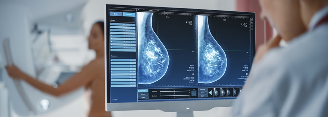 Digital Mammography (DM)